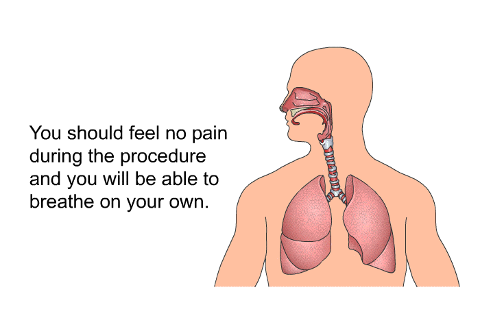 You should feel no pain during the procedure and you will be able to breathe on your own.