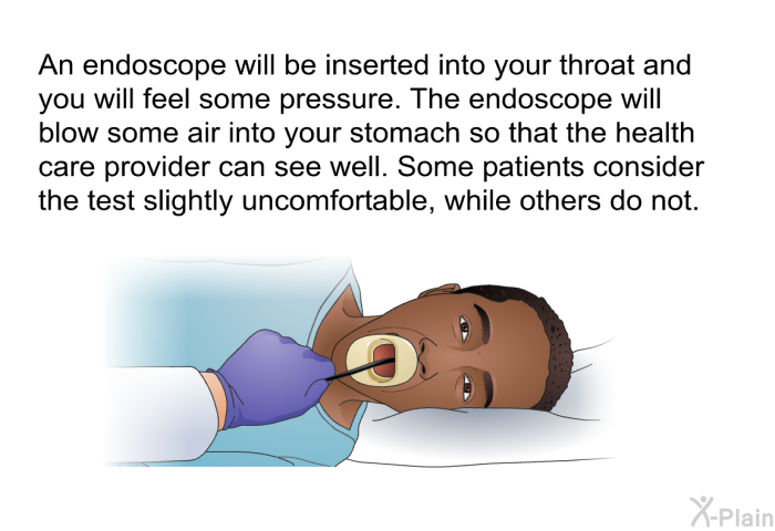 An endoscope will be inserted into your throat and you will feel some pressure. The endoscope will blow some air into your stomach so that the health care provider can see well. Some patients consider the test slightly uncomfortable, while others do not.