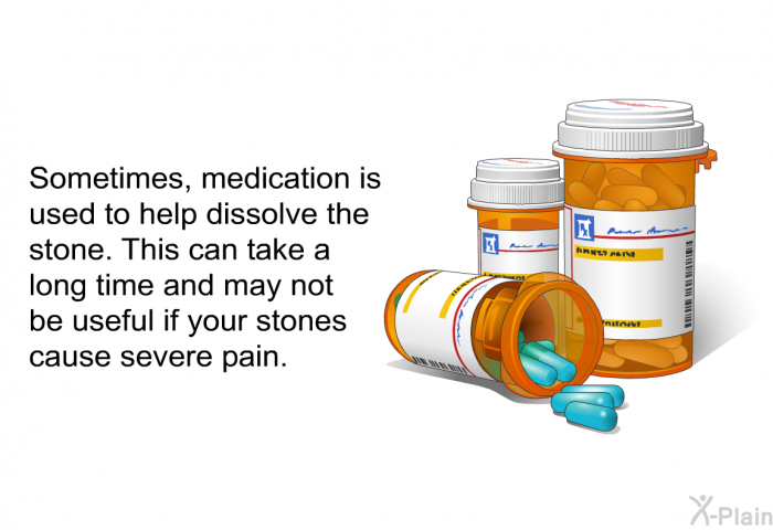 Sometimes, medication is used to help dissolve the stone. This can take a long time and may not be useful if your stones cause severe pain.