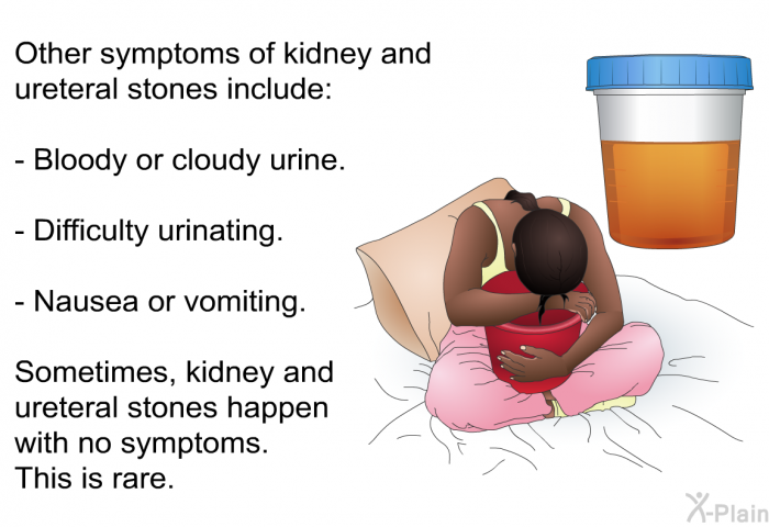 Other symptoms of kidney and ureteral stones include:  Bloody or cloudy urine. Difficulty urinating. Nausea or vomiting.  
 Sometimes, kidney and ureteral stones happen with no symptoms. This is rare.