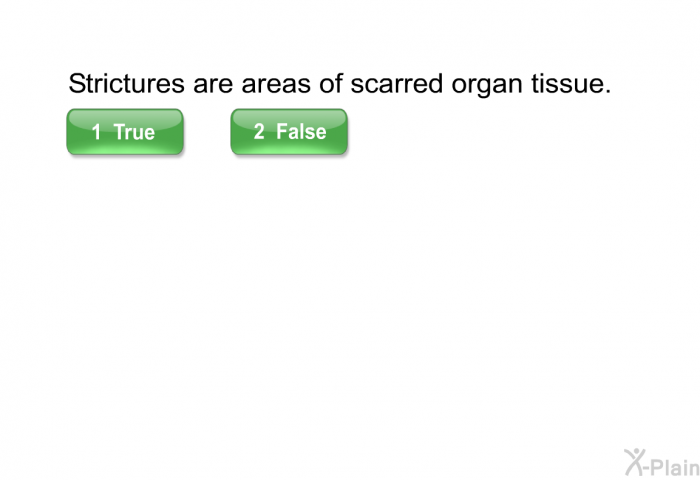Strictures are areas of scarred organ tissue.