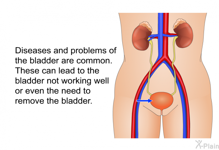 Diseases and problems of the bladder are common. These can lead to the bladder not working well or even the need to remove the bladder.