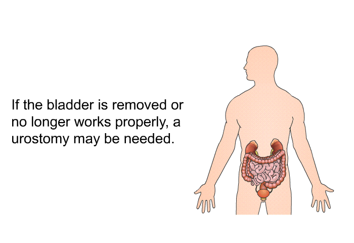 If the bladder is removed or no longer works properly, a urostomy may be needed.