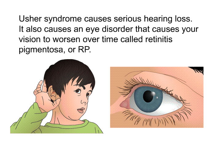 Usher syndrome causes serious hearing loss. It also causes an eye disorder that causes your vision to worsen over time called retinitis pigmentosa, or RP.