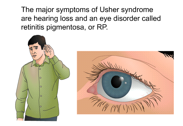 The major symptoms of Usher syndrome are hearing loss and an eye disorder called retinitis pigmentosa, or RP.