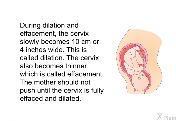 During dilation and effacement, the cervix slowly becomes 10 cm or 4 inches wide. This is called dilation. The cervix also becomes thinner which is called effacement. The mother should not push until the cervix is fully effaced and dilated.
