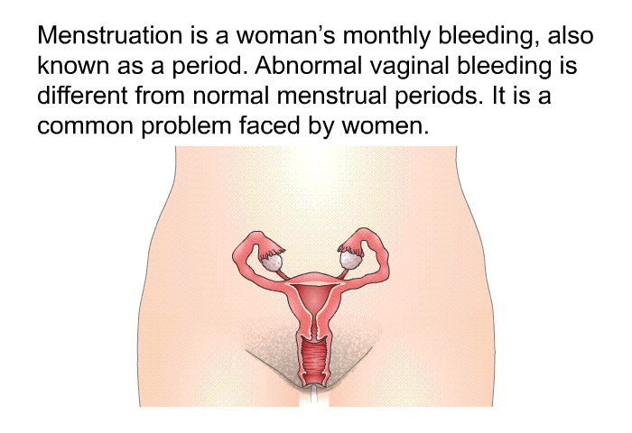 Menstruation is a woman's monthly bleeding, also known as a period. Abnormal vaginal bleeding is different from normal menstrual periods. It is a common problem faced by women.