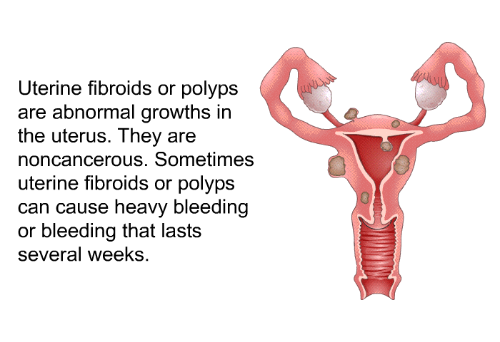Uterine fibroids or polyps are abnormal growths in the uterus. They are noncancerous. Sometimes uterine fibroids or polyps can cause heavy bleeding or bleeding that lasts several weeks.