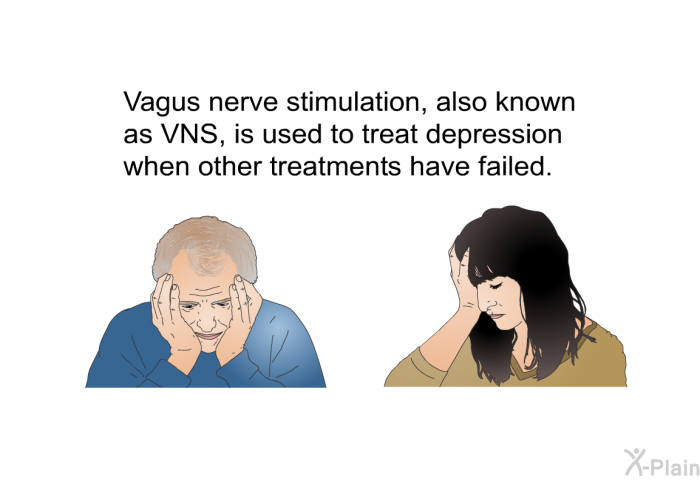 Vagus nerve stimulation, also known as VNS, is used to treat depression when other treatments have failed.