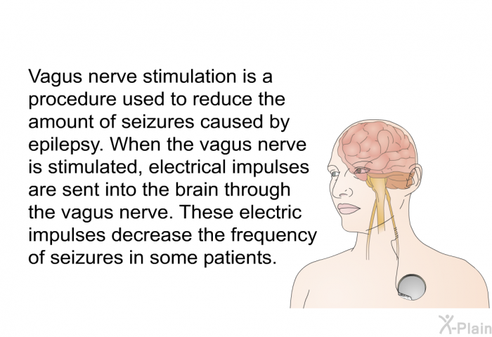 Vagus nerve stimulation is a procedure used to reduce the amount of seizures caused by epilepsy. When the vagus nerve is stimulated, electrical impulses are sent into the brain through the vagus nerve. These electric impulses decrease the frequency of seizures in some patients.