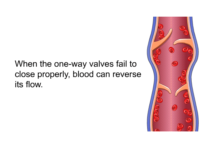 When the one-way valves fail to close properly, blood can reverse its flow.