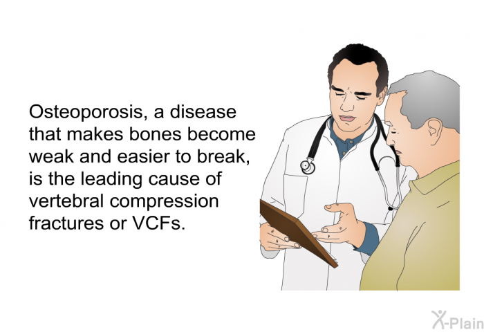 Osteoporosis, a disease that makes bones become weak and easier to break, is the leading cause of vertebral compression fractures or VCFs.