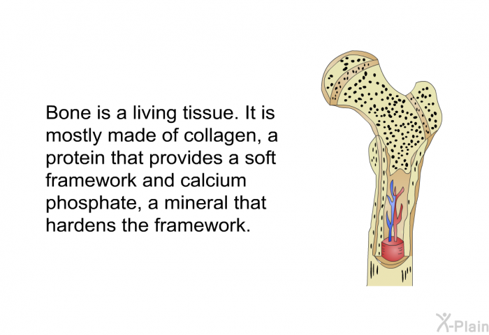 Bone is a living tissue. It is mostly made of collagen, a protein that provides a soft framework and calcium phosphate, a mineral that hardens the framework.