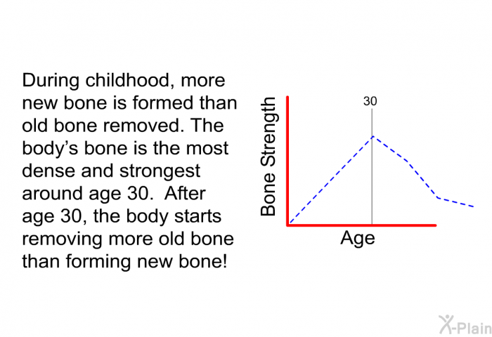During childhood, more new bone is formed than old bone removed. The body's bone is the most dense and strongest around age 30. After age 30, the body starts removing more old bone than forming new bone!