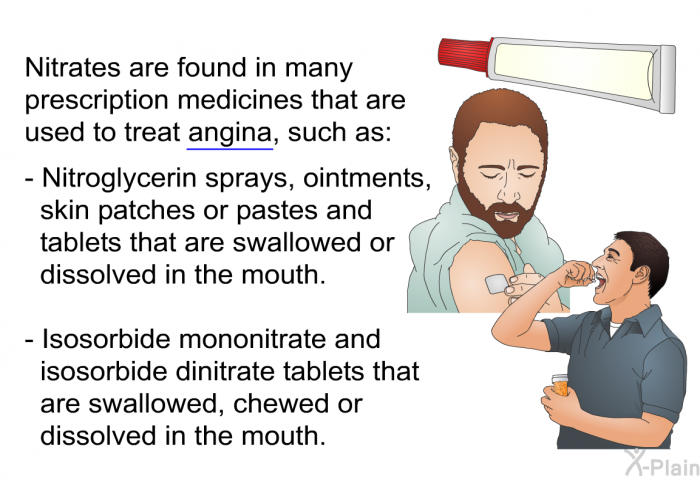 Nitrates are found in many prescription medicines that are used to treat angina, such as:  Nitroglycerin sprays, ointments, skin patches or pastes and tablets that are swallowed or dissolved in the mouth. Isosorbide mononitrate and isosorbide dinitrate tablets that are swallowed, chewed or dissolved in the mouth.
