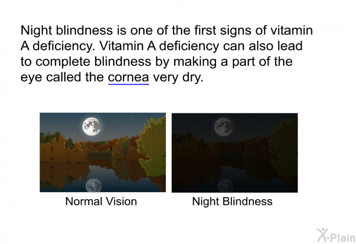Night blindness is one of the first signs of vitamin A deficiency. Vitamin A deficiency can also lead to complete blindness by making a part of the eye called the cornea very dry.