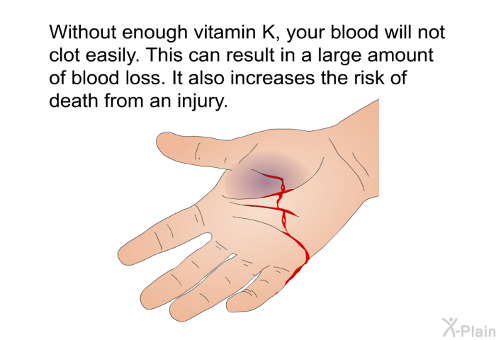 Without enough vitamin K, your blood will not clot easily. This can result in a large amount of blood loss. It also increases the risk of death from an injury.