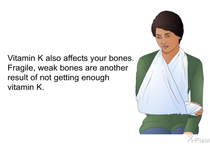 Vitamin K also affects your bones. Fragile, weak bones are another result of not getting enough vitamin K.