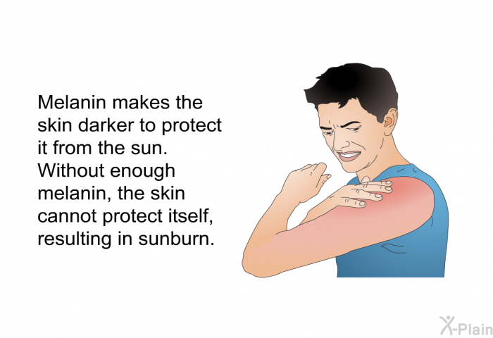 Melanin makes the skin darker to protect it from the sun. Without enough melanin, the skin cannot protect itself, resulting in sunburn.