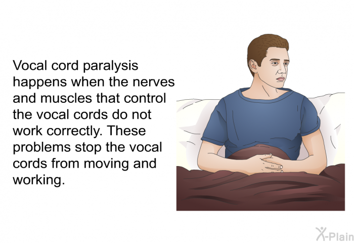 Vocal cord paralysis happens when the nerves and muscles that control the vocal cords do not work correctly. These problems stop the vocal cords from moving and working.