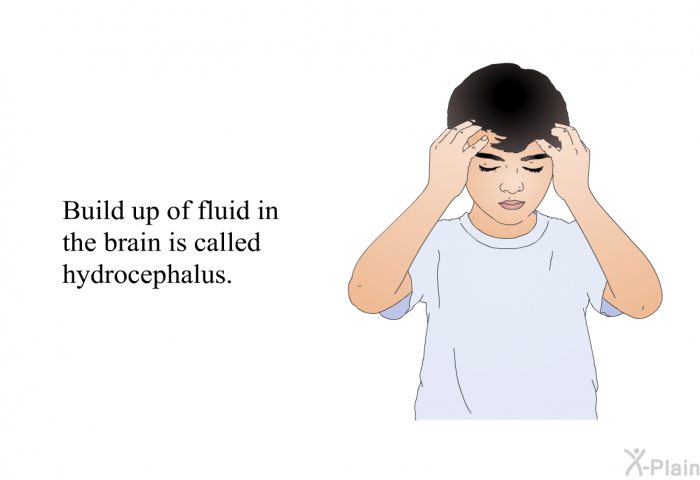 Build up of fluid in the brain is called “hydrocephalus”.