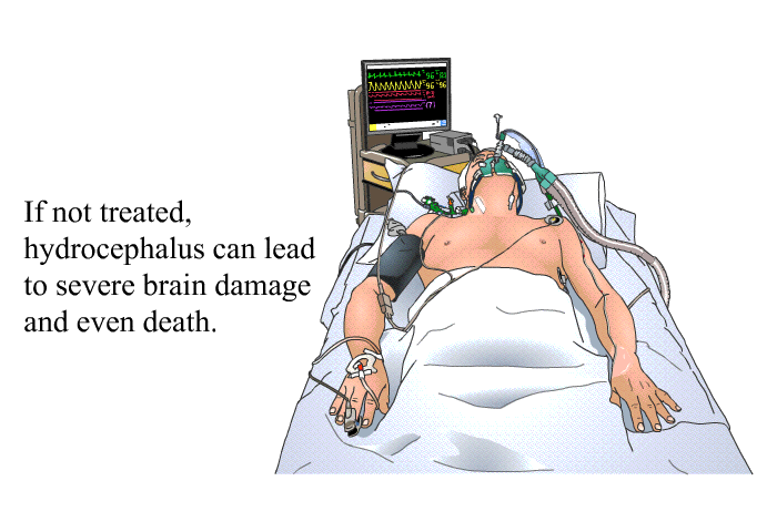 If not treated, hydrocephalus can lead to severe brain damage and even death.