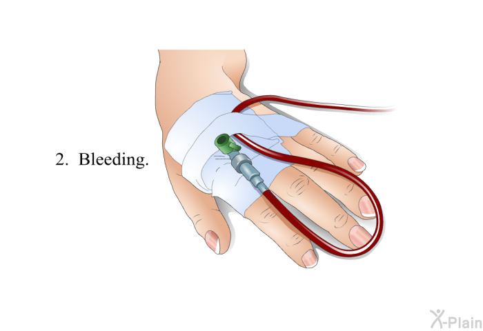 Bleeding.