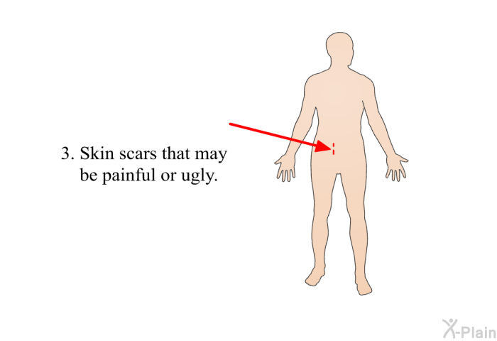 Skin scars that may be painful or ugly.