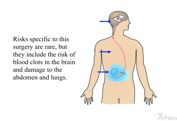 Risks specific to this surgery are rare, but they include the risk of blood clots in the brain and damage to the abdomen and lungs.