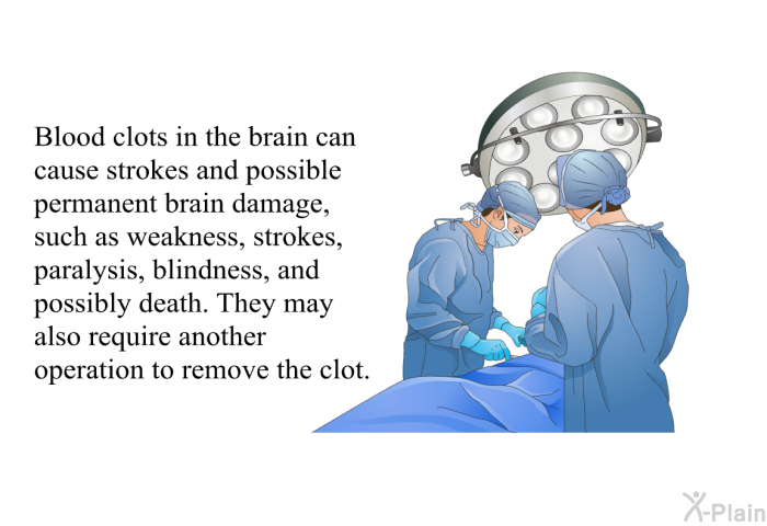 Blood clots in the brain can cause strokes and possible permanent brain damage, such as weakness, strokes, paralysis, blindness, and possibly death. They may also require another operation to remove the clot.