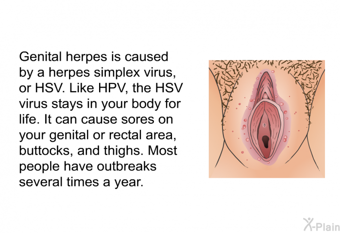 Genital herpes is caused by a herpes simplex virus, or HSV. Like HPV, the HSV virus stays in your body for life. It can cause sores on your genital or rectal area, buttocks and thighs. Most people have outbreaks several times a year.