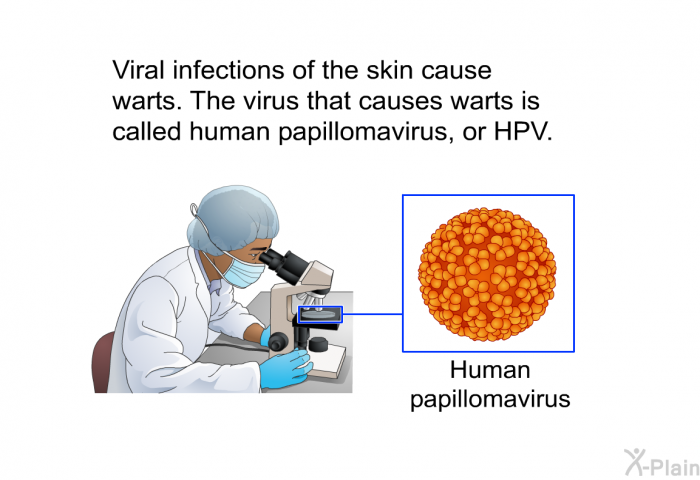 Viral infections of the skin cause warts. The virus that causes warts is called human papillomavirus, or HPV.