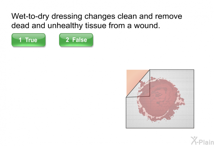 Wet-to-dry dressing changes clean and remove dead and unhealthy tissue from a wound. Select True or False.