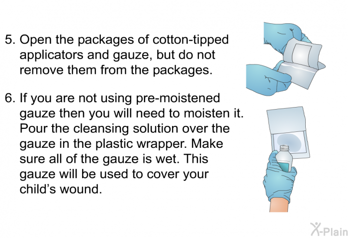 Open the packages of cotton-tipped applicators and gauze, but do not remove them from the packages. If you are not using pre-moistened gauze then you will need to moisten it. Pour the cleansing solution over the gauze in the plastic wrapper. Make sure all of the gauze is wet. This gauze will be used to cover your child’s wound.