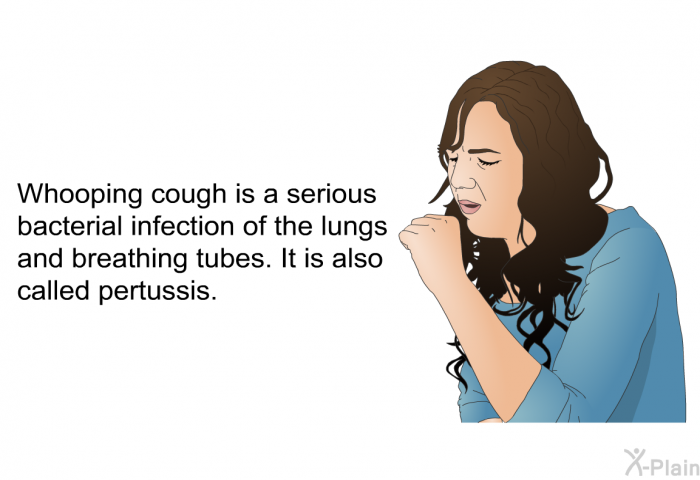 Whooping cough is a serious bacterial infection of the lungs and breathing tubes. It is also called pertussis.