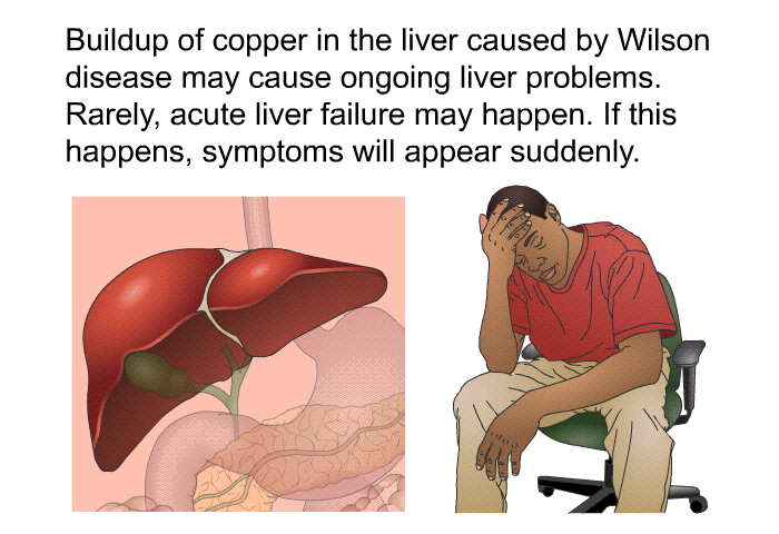 Buildup of copper in the liver caused by Wilson disease may cause ongoing liver problems. Rarely, acute liver failure may happen. If this happens, symptoms will appear suddenly.