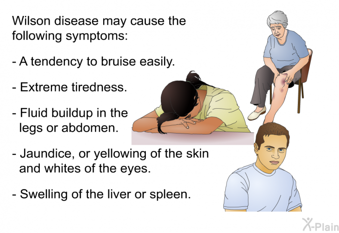 Wilson disease may cause the following symptoms:  A tendency to bruise easily. Extreme tiredness. Fluid buildup in the legs or abdomen. Jaundice, or yellowing of the skin and whites of the eyes. Swelling of the liver or spleen.