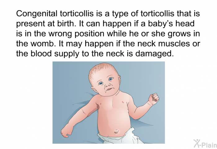 Congenital torticollis is a type of torticollis that is present at birth. It can happen if a baby's head is in the wrong position while he or she grows in the womb. It may happen if the neck muscles or the blood supply to the neck is damaged.