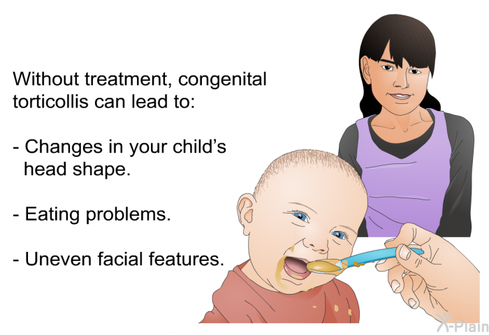 Without treatment, congenital torticollis can lead to:  Changes in your child's head shape. Eating problems. Uneven facial features.