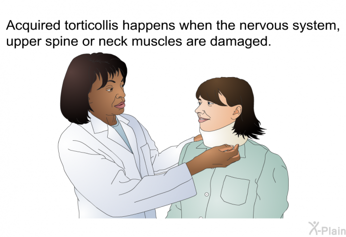 Acquired torticollis happens when the nervous system, upper spine or neck muscles are damaged.