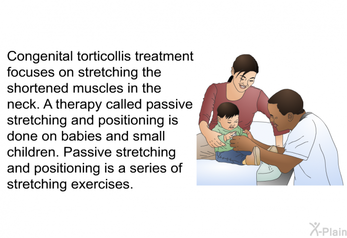 Congenital torticollis treatment focuses on stretching the shortened muscles in the neck. A therapy called passive stretching and positioning is done on babies and small children. Passive stretching and positioning is a series of stretching exercises.