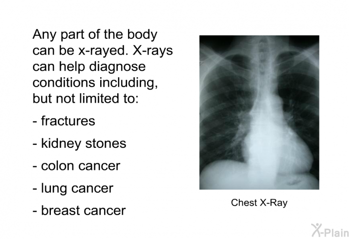 Any part of the body can be x-rayed. X-rays can help diagnose conditions including, but not limited to:  fractures kidney stones colon cancer lung cancer breast cancer