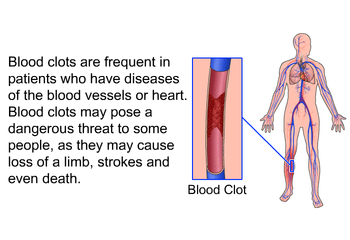 Blood clots are frequent in patients who have diseases of the blood vessels or heart. Blood clots may pose a dangerous threat to some people, as they may cause loss of a limb, strokes and even death.