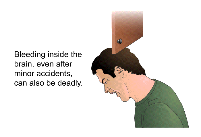 Bleeding inside the brain, even after minor accidents, can also be deadly.