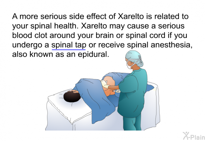 A more serious side effect of Xarelto is related to your spinal health. Xarelto may cause a serious blood clot around your brain or spinal cord if you undergo a spinal tap or receive spinal anesthesia, also known as an epidural.