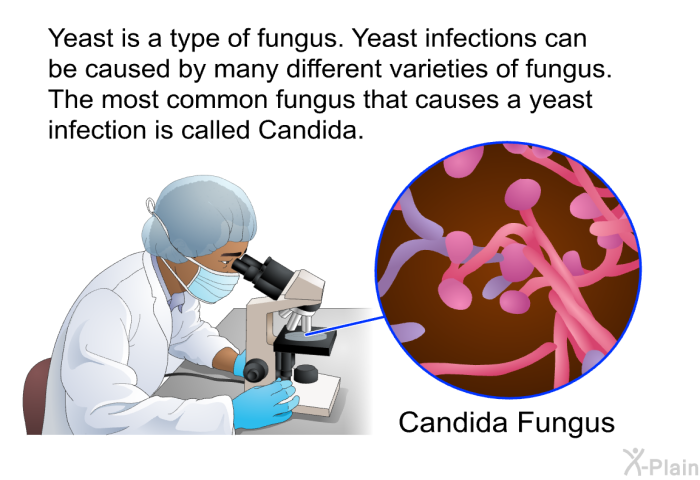 Yeast is a type of fungus. Yeast infections can be caused by many different varieties of fungus. The most common fungus that causes a yeast infection is called Candida.