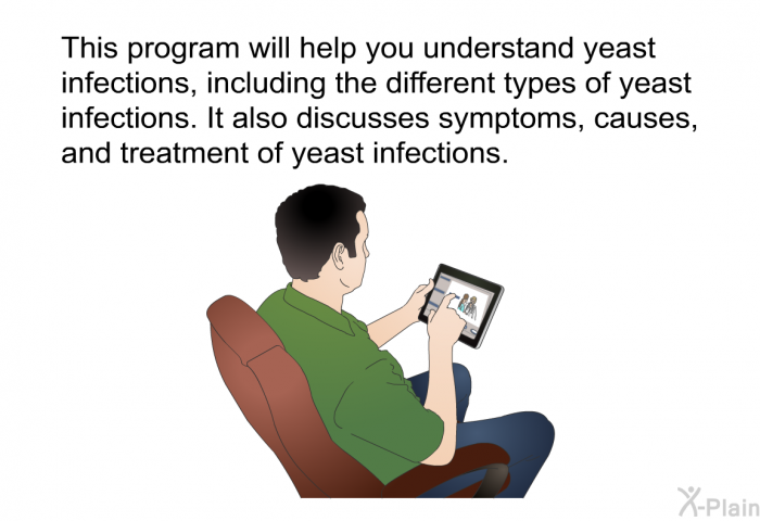 This health information will help you understand yeast infections, including the different types of yeast infections. It also discusses symptoms, causes, and treatment of yeast infections.