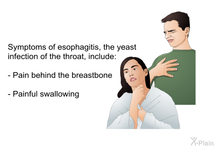 Symptoms of esophagitis, the yeast infection of the throat, include:  Pain behind the breastbone Painful swallowing