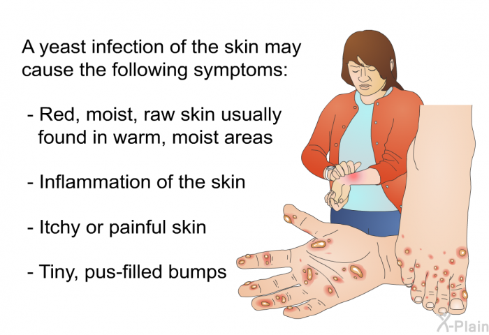 A yeast infection of the skin may cause the following symptoms:  Red, moist, raw skin usually found in warm, moist areas Inflammation of the skin Itchy or painful skin Tiny, pus-filled bumps