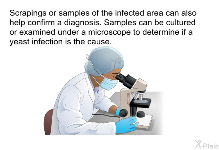 Scrapings or samples of the infected area can also help confirm a diagnosis. Samples can be cultured or examined under a microscope to determine if a yeast infection is the cause.